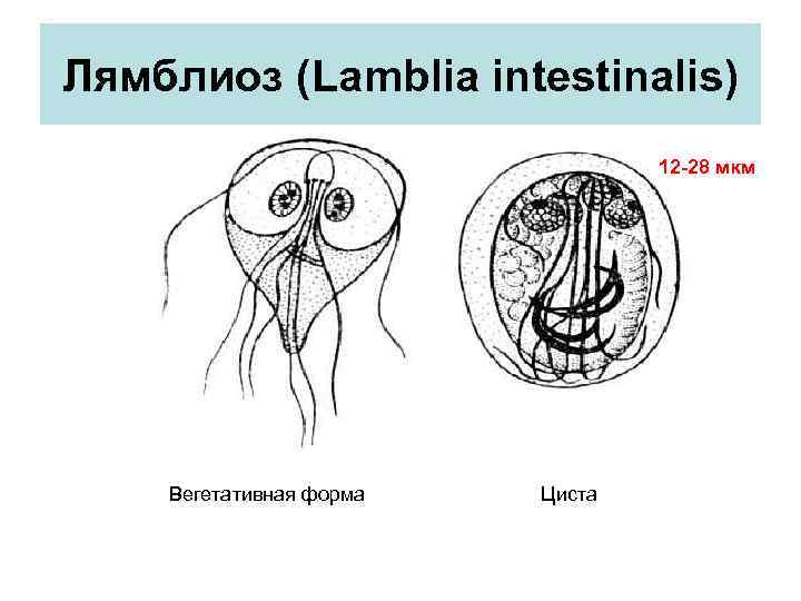 Лямблиоз (Lamblia intestinalis) 12 -28 мкм Вегетативная форма Циста 