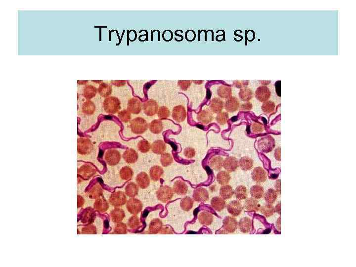 Trypanosoma sp. 