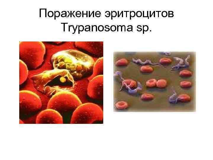 Поражение эритроцитов Trypanosoma sp. 