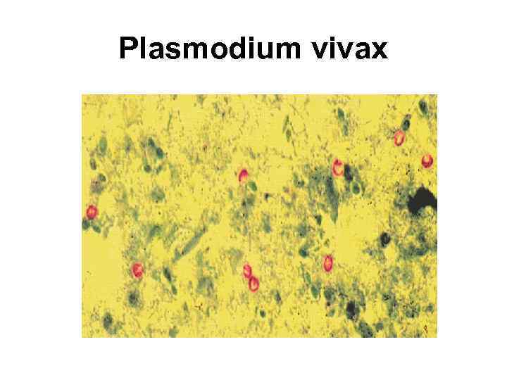 Plasmodium vivax 