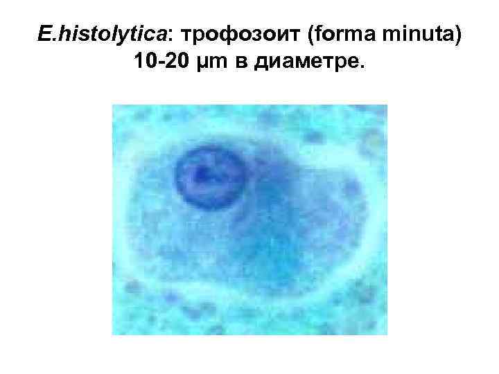 E. histolytica: трофозоит (forma minuta) 10 -20 µm в диаметре. 