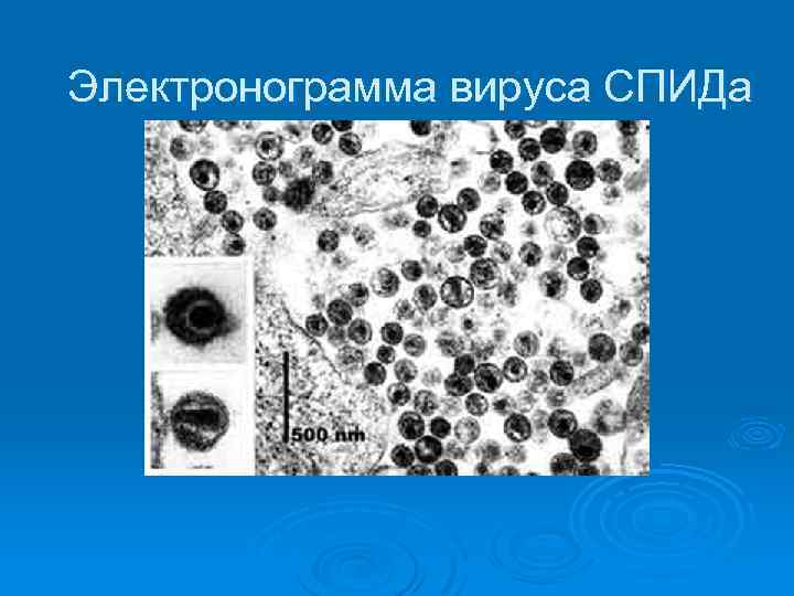 Электронограмма вируса СПИДа 