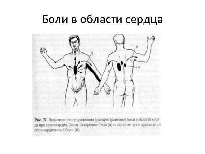 Боли в области сердца 