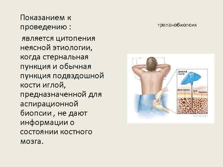 Что такое трепанобиопсия. Показания к исследованию костного мозга. Биопсия костного мозга показания. Техника проведения пункции костного мозга. Пункция красного костного мозга из грудины.