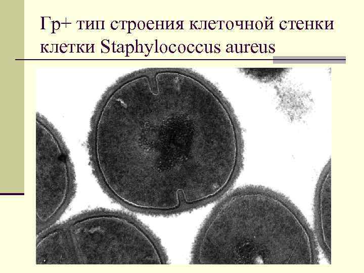 Гр+ тип строения клеточной стенки клетки Staphylococcus aureus 