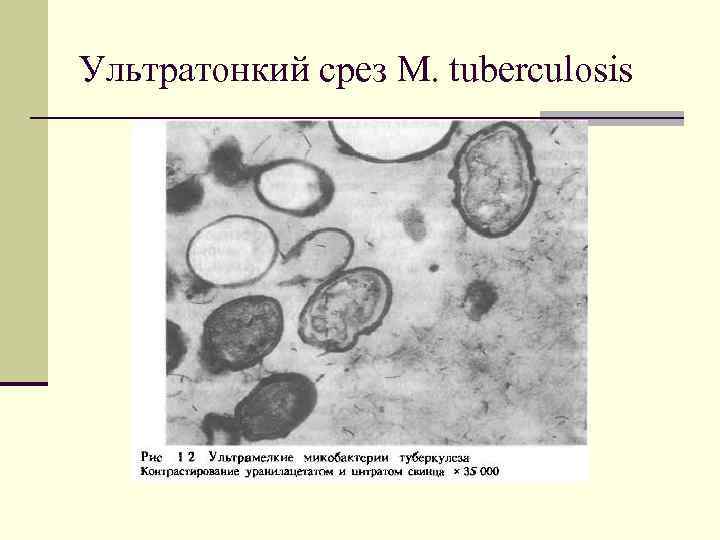 Ультратонкий срез M. tuberculosis 