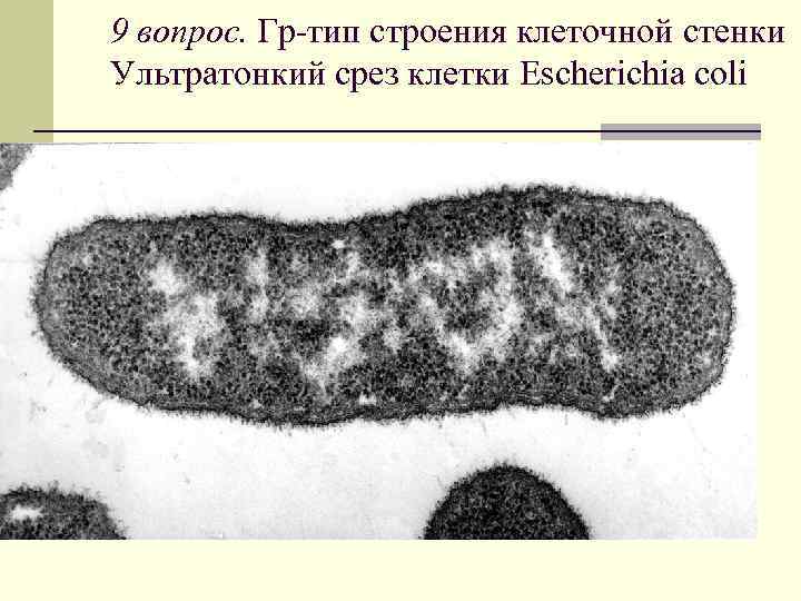 9 вопрос. Гр-тип строения клеточной стенки Ультратонкий срез клетки Escherichia coli 