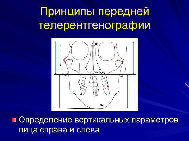 Принципы передней телерентгенографии Определение вертикальных параметров лица справа и слева 