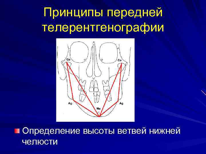 Принципы передней телерентгенографии Определение высоты ветвей нижней челюсти 