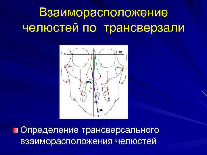 Взаиморасположение челюстей по трансверзали Определение трансверсального взаиморасположения челюстей 