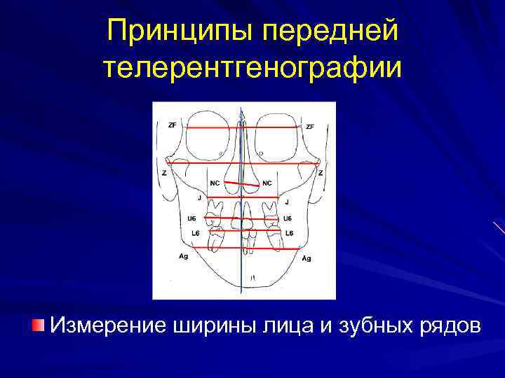 Принципы передней телерентгенографии Измерение ширины лица и зубных рядов 