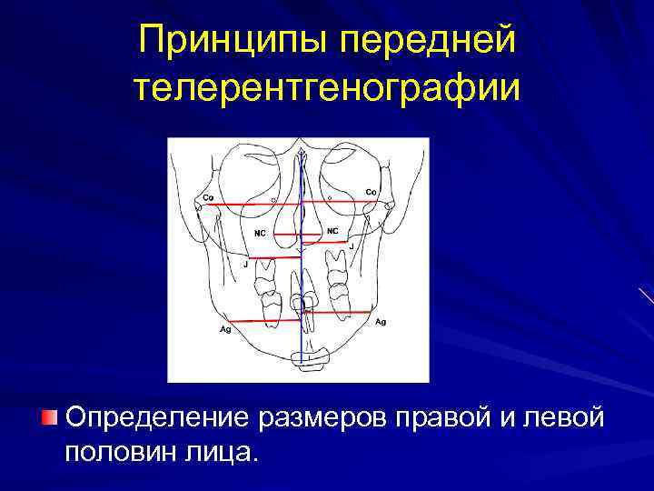 Принципы передней телерентгенографии Определение размеров правой и левой половин лица. 