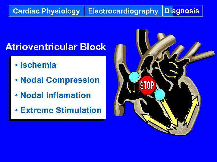 Cardiac Physiology Electrocardiography Diagnosis Atrioventricular Block • Ischemia • Nodal Compression • Nodal Inflamation