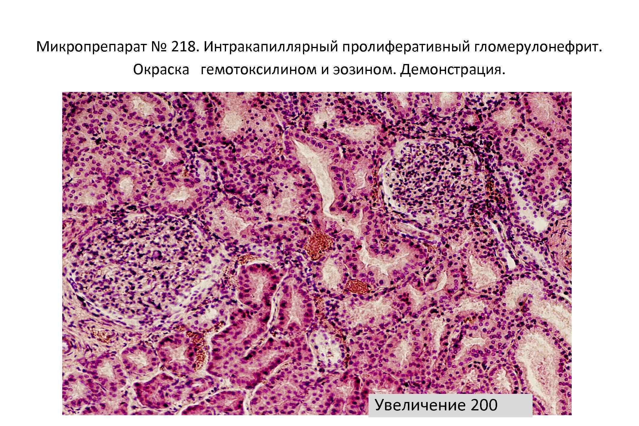 Описание микропрепарата