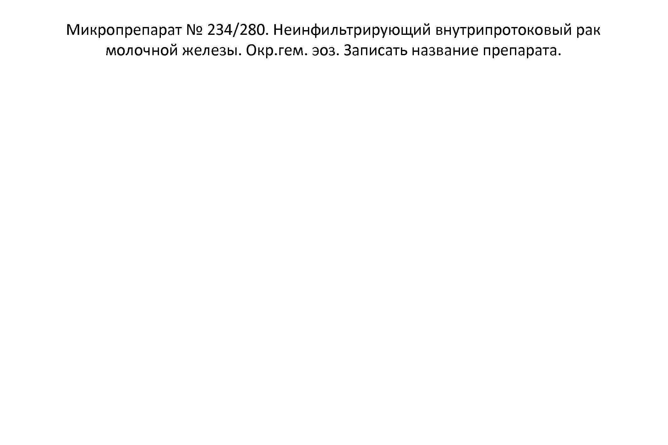 Микропрепарат № 234/280. Неинфильтрирующий внутрипротоковый рак молочной железы. Окр. гем. эоз. Записать название препарата.
