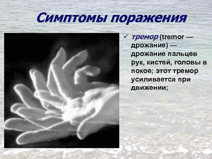 Симптомы поражения ü тремор (tremor — дрожание) — дрожание пальцев рук, кистей, головы в