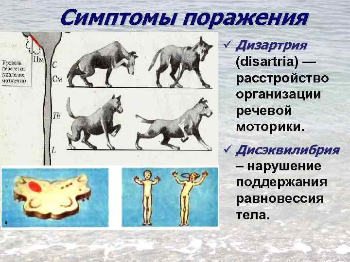 Симптомы поражения ü Дизартрия (disartria) — расстройство организации речевой моторики. ü Дисэквилибрия – нарушение
