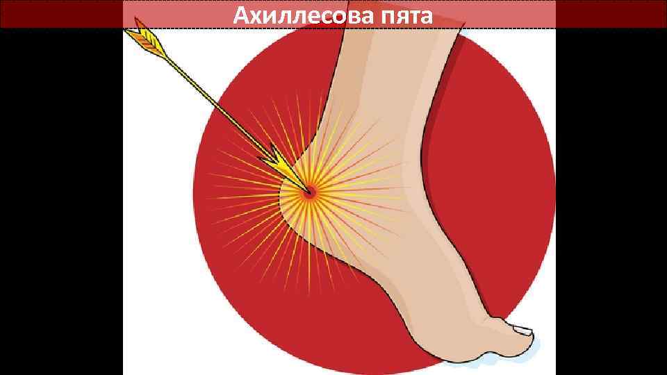 Ахиллесова пята 