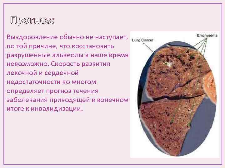 Прогноз: Выздоровление обычно не наступает, по той причине, что восстановить разрушенные альвеолы в наше