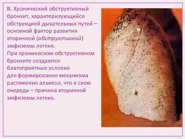 II. Хронический обструктивный бронхит, характеризующийся обструкцией дыхательных путей – основной фактор развития вторичной (обструктивной)