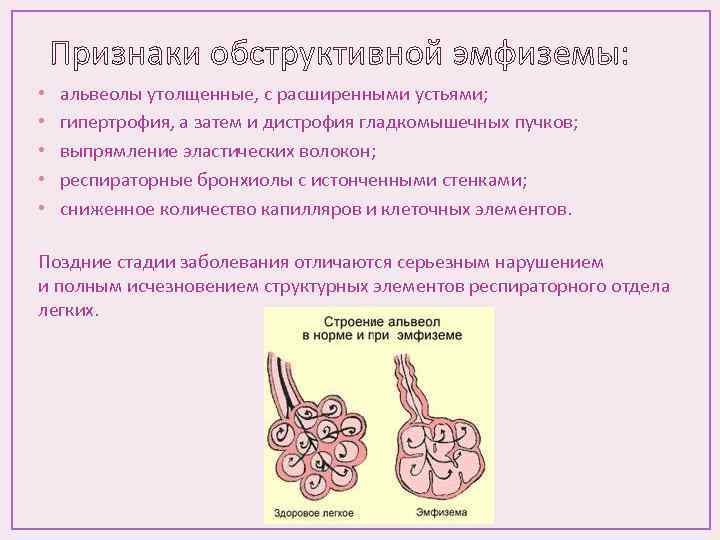 Признаки обструктивной эмфиземы: • • • альвеолы утолщенные, с расширенными устьями; гипертрофия, а затем