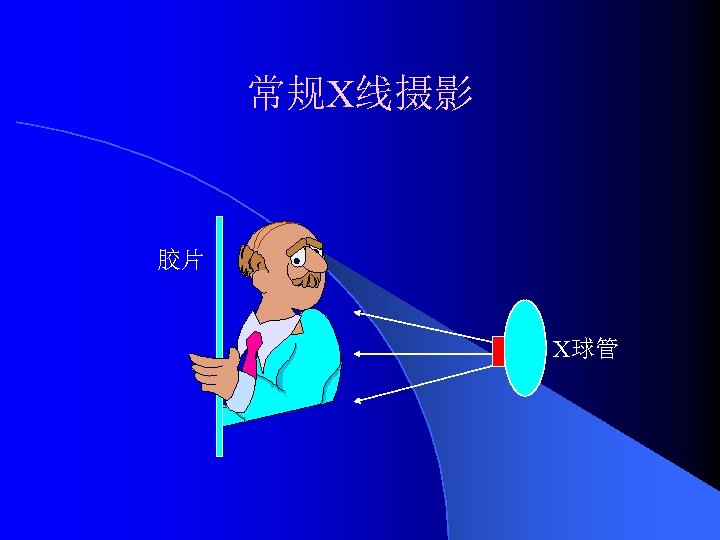 常规X线摄影 胶片 X球管 