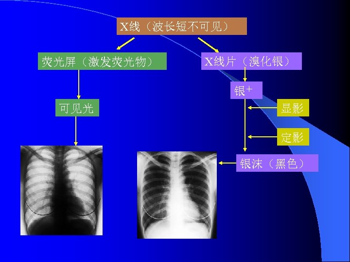 X线（波长短不可见） 荧光屏（激发荧光物） X线片（溴化银） 银＋ 可见光 显影 定影 银沫（黑色） 