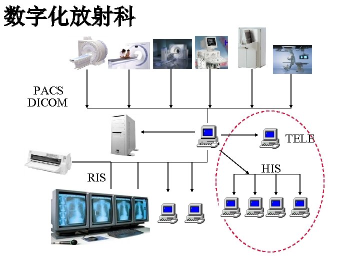 数字化放射科 DSA PACS DICOM TELE RIS HIS 