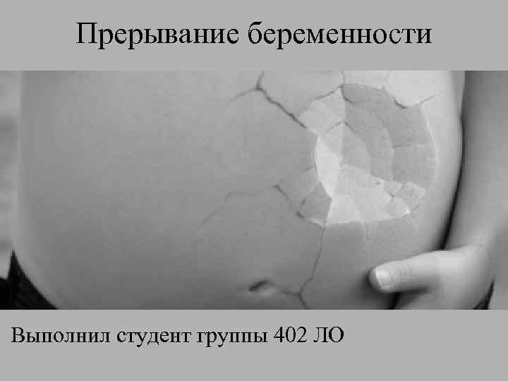 Прерывание беременности Выполнил студент группы 402 ЛО 