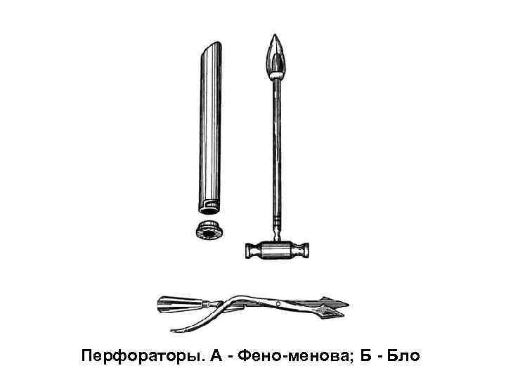 Перфораторы. А - Фено-менова; Б - Бло 