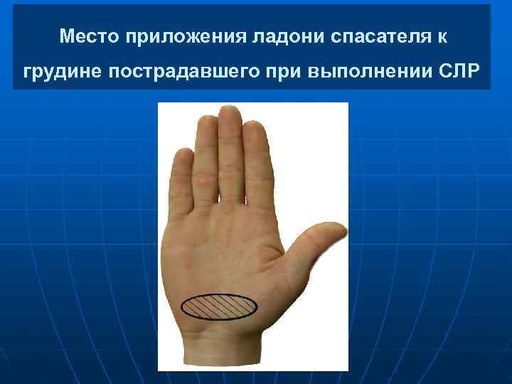 Место приложения ладони спасателя к грудине пострадавшего при выполнении СЛР 