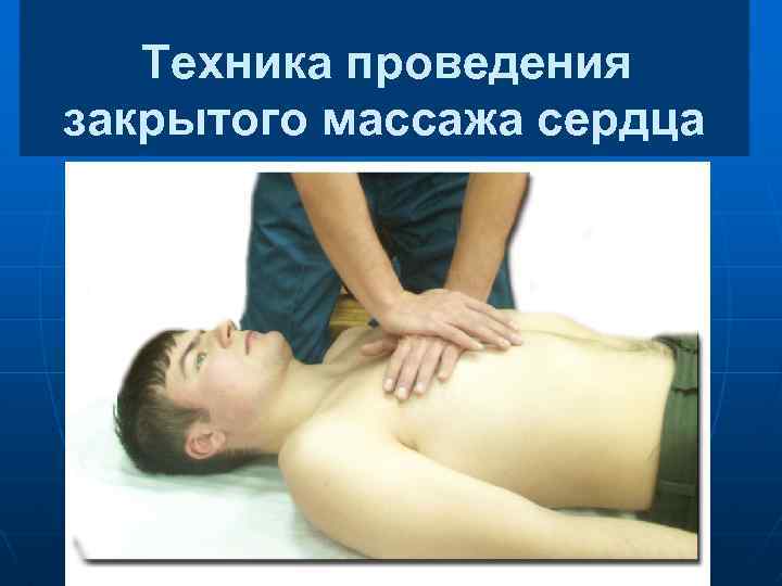Техника проведения закрытого массажа сердца 