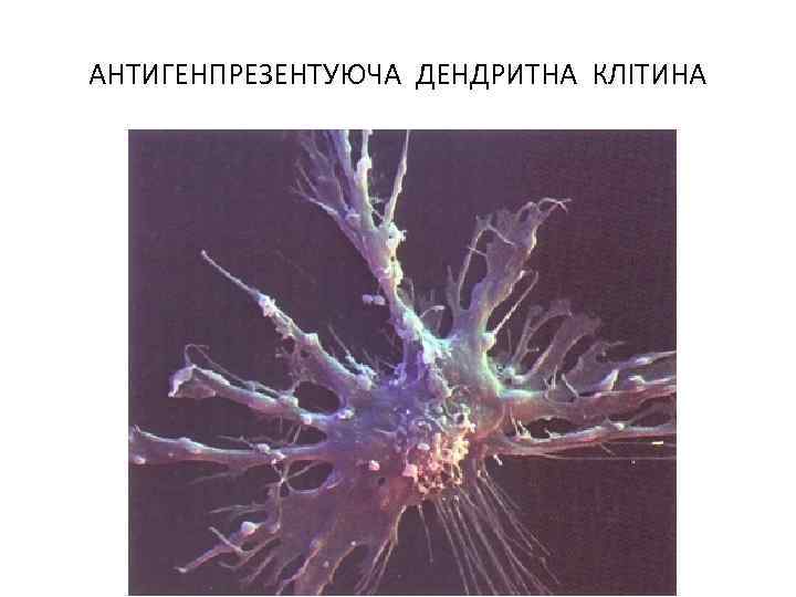 АНТИГЕНПРЕЗЕНТУЮЧА ДЕНДРИТНА КЛІТИНА 