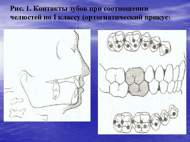 Рис. 1. Контакты зубов при соотношении челюстей по I классу (ортогнатический прикус). 