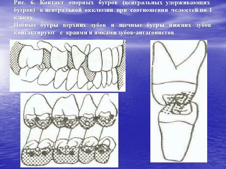 Рис. 6. Контакт опорных бугров (центральных удерживающих бугров) в центральной окклюзии при соотношении челюстей