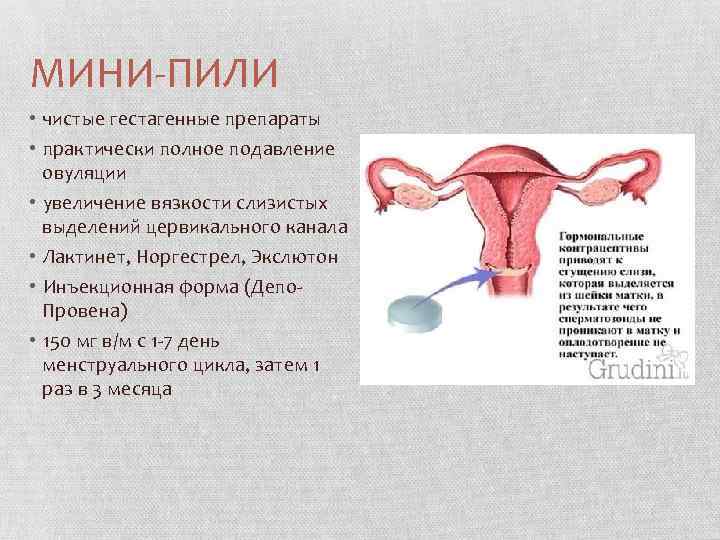 МИНИ-ПИЛИ • чистые гестагенные препараты • практически полное подавление овуляции • увеличение вязкости слизистых