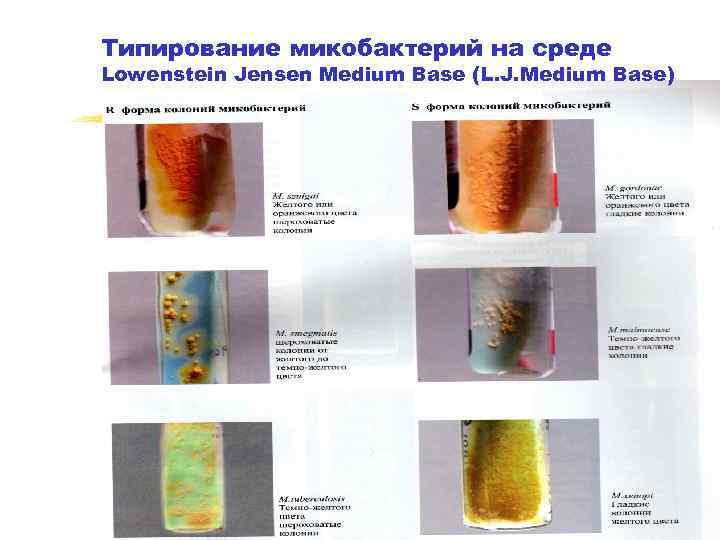Типирование микобактерий на среде Lowenstein Jensen Medium Base (L. J. Medium Base) 