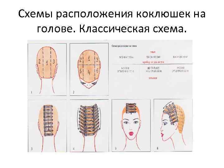 Схемы расположения коклюшек на голове. Классическая схема. 