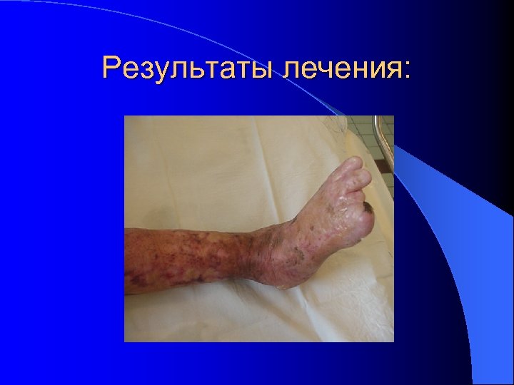 Результаты лечения: 