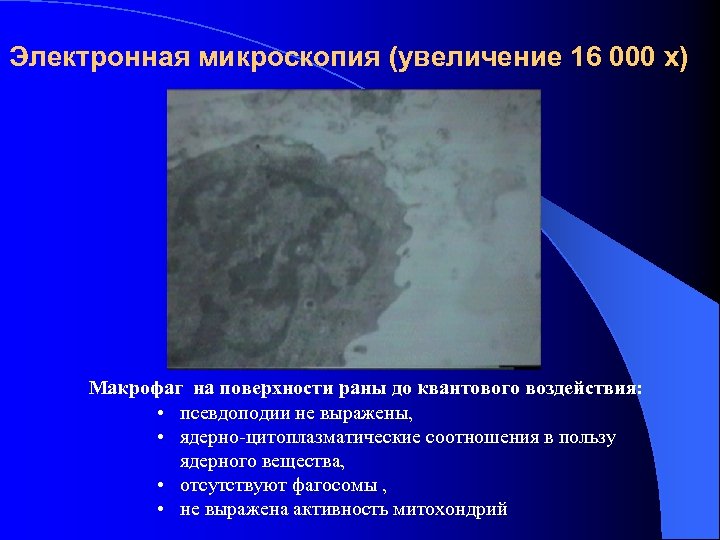 Электронная микроскопия (увеличение 16 000 х) Макрофаг на поверхности раны до квантового воздействия: •