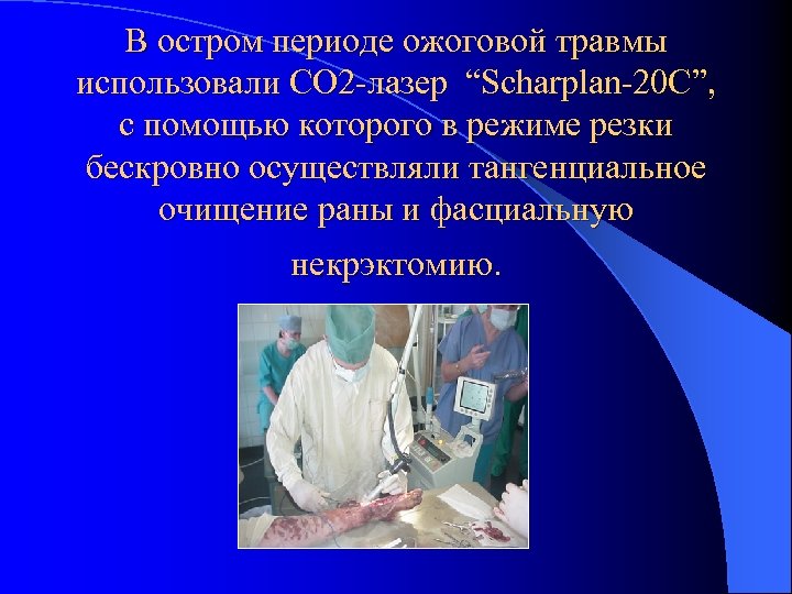 В остром периоде ожоговой травмы использовали СО 2 -лазер “Scharplan-20 C”, с помощью которого