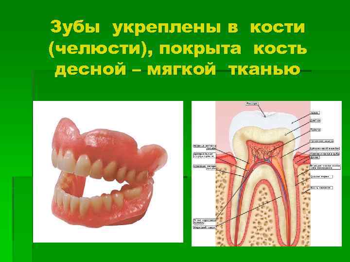 Зубы укреплены в кости (челюсти), покрыта кость десной – мягкой тканью 