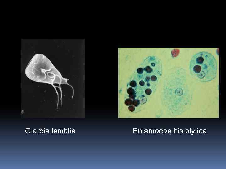 Giardia lamblia Entamoeba histolytica 