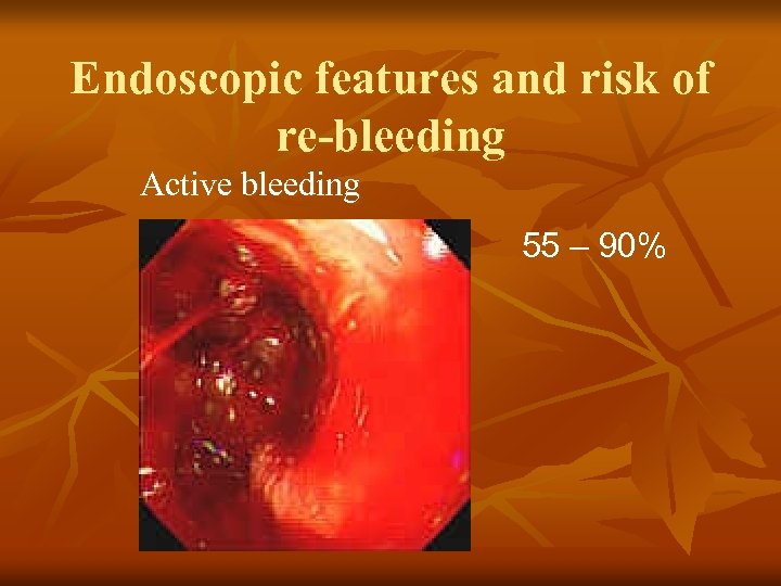 Endoscopic features and risk of re-bleeding Active bleeding 55 – 90% 