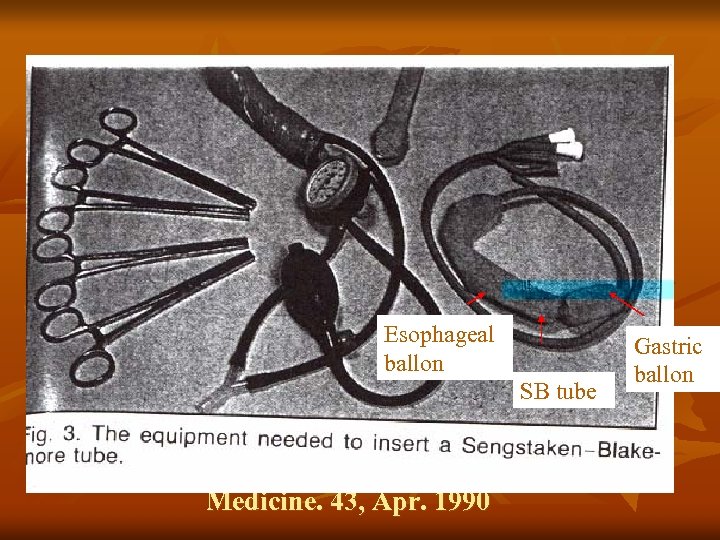 Esophageal ballon SB tube Mc. Cormick. British Journal of Hospital Medicine. 43, Apr. 1990