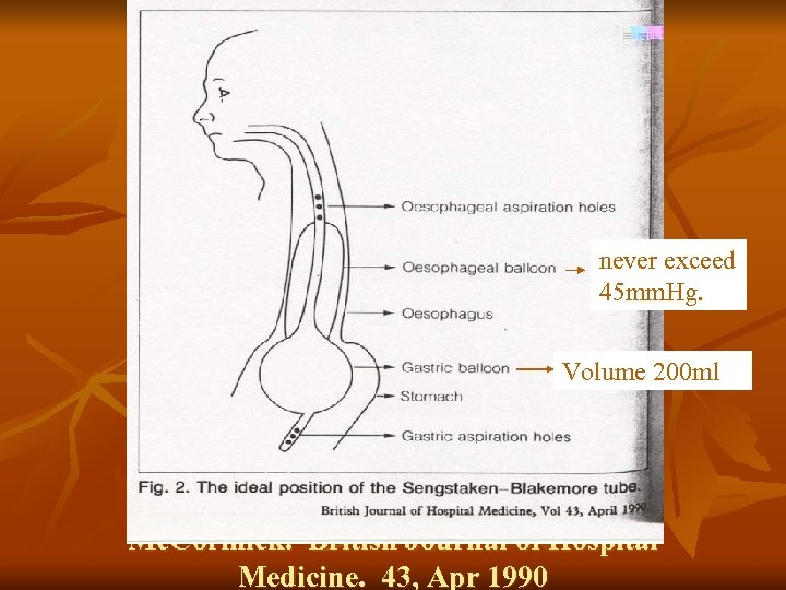 never exceed 45 mm. Hg. Volume 200 ml Mc. Cormick. British Journal of Hospital