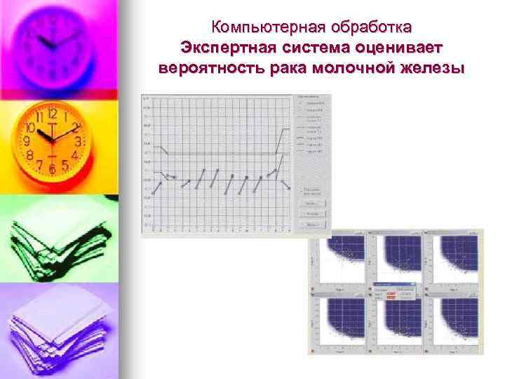 Компьютерная обработка Экспертная система оценивает вероятность рака молочной железы 