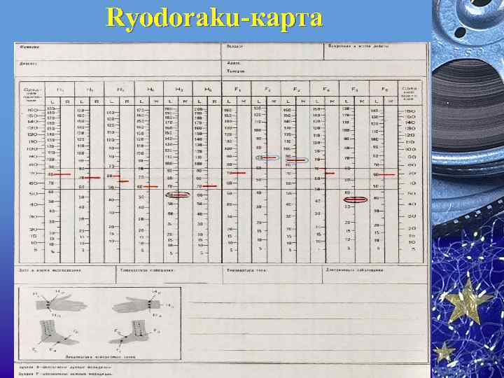 Ryodoraku-карта 