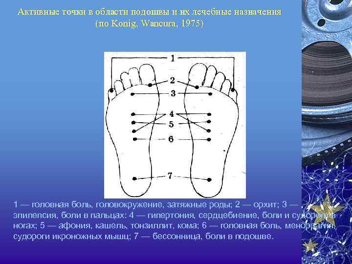 Активные точки в области подошвы и их лечебные назначения (по Konig, Wancura, 1975) 1