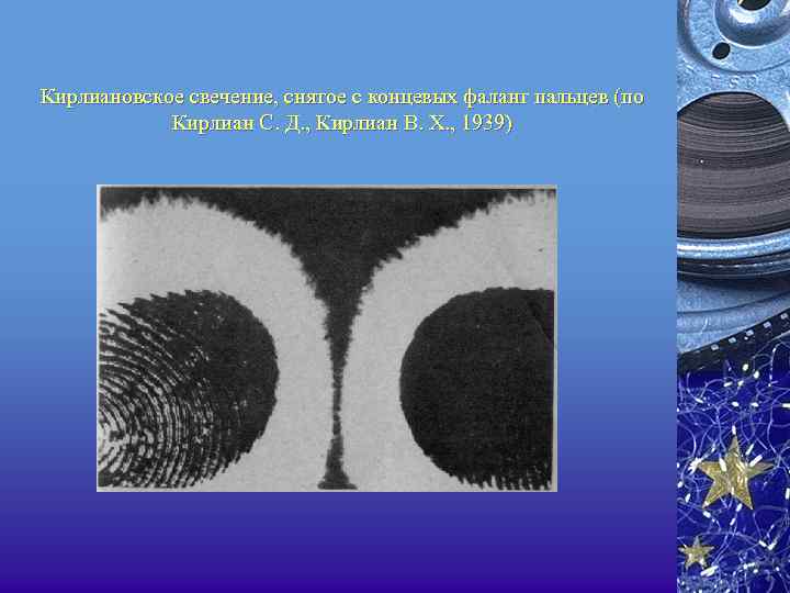 Кирлиановское свечение, снятое с концевых фаланг пальцев (по Кирлиан С. Д. , Кирлиан В.